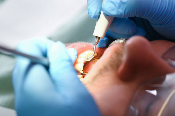 Best Emergency Treatment for Dental Infections or Abscesses in Baldwin, PA