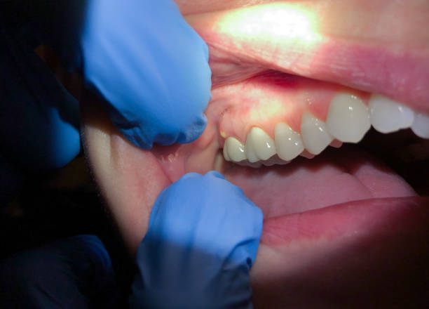 Best Emergency TMJ Treatment in Baldwin, PA